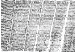NEET Biology Animal Tissues MCQs Set D-Q72