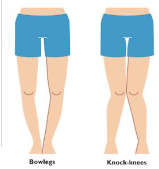 Notes CBSE Class 12 Physical Education Children and Sports