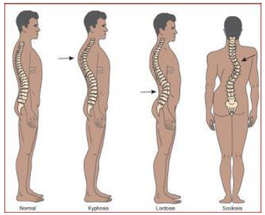 Notes CBSE Class 12 Physical Education Children and Sports