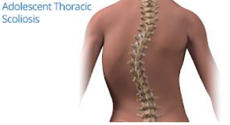 Notes CBSE Class 12 Physical Education Children and Sports