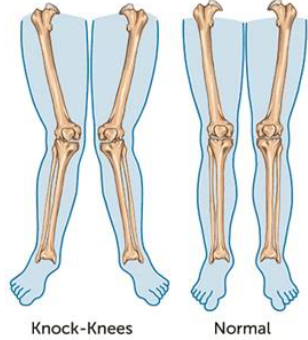 Notes CBSE Class 12 Physical Education Children and Sports