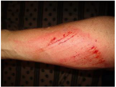 Notes CBSE Class 12 Physical Education Sports Medicine