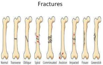 Notes CBSE Class 12 Physical Education Sports Medicine
