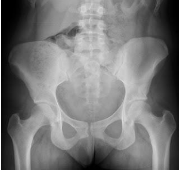 Notes CBSE Class 12 Physical Education Sports Medicine