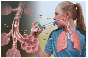 Notes CBSE Class 12 Physical Education Yoga and Lifestyle