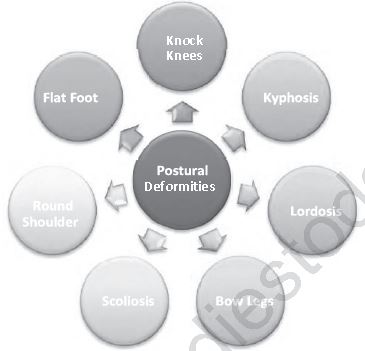 Class 12 Physical Education Children And Women In Sports_13