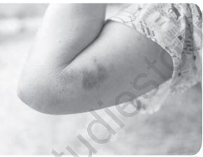 Class 12 Physical Education Physiology And Injuries In Sports_17