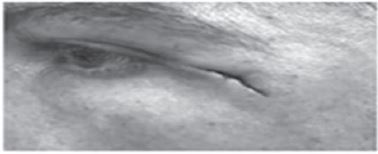 Class 12 Physical Education Physiology And Injuries In Sports_18