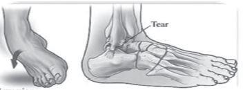 Class 12 Physical Education Physiology And Injuries In Sports_20