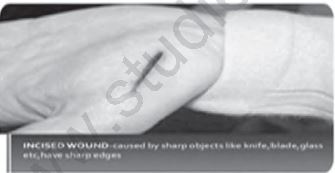 Class 12 Physical Education Physiology And Injuries In Sports_21