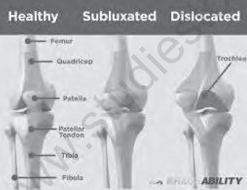 Class 12 Physical Education Physiology And Injuries In Sports_23