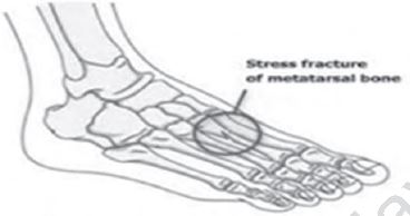 Class 12 Physical Education Physiology And Injuries In Sports_24