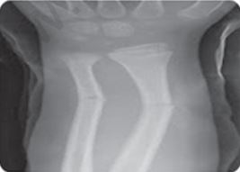 Class 12 Physical Education Physiology And Injuries In Sports_25