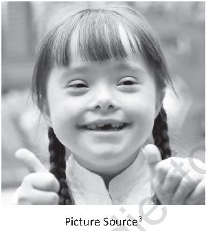 Class 12 Physical Education Planning And Sports For Children With Special_8